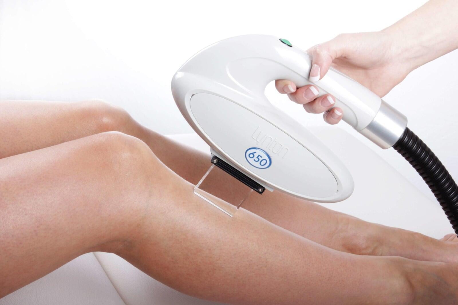 IPL Hair Removal